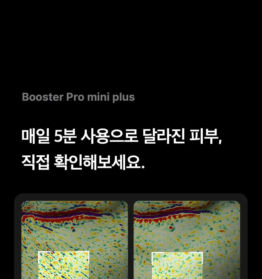 [7월 올영픽][한교동 장바구니백 증정] 메디큐브 에이지알 미니플러스 한교동 에디션/짱구 에디션/핑크/베이지 택 1 상세페이지 70